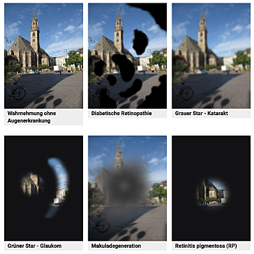 Simulation verschiedener Sehbeeinträchtigungen: Diabetische Retinopathie, Katarakt, Glaukom, Makuladegeneration und Retinopathie Pigmentosa